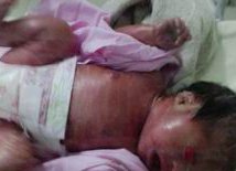 未婚／单身试管必看，加美精子存储医院全流程费用清单+成功率提升技巧